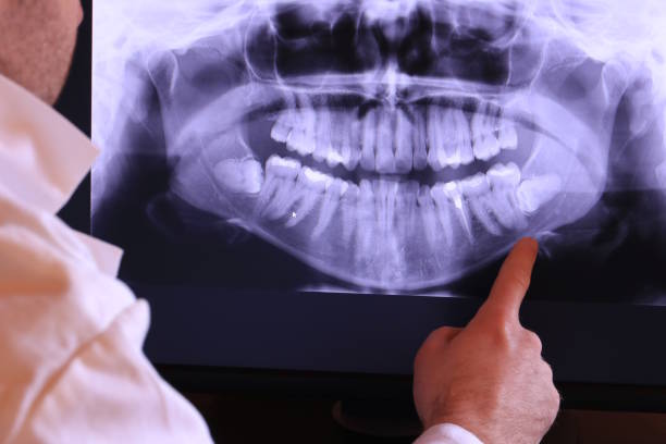 Best After-Hours Emergency Dentist in Steelevle, IL