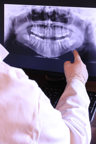 Best Emergency Wisdom Teeth Removal in Steelevle, IL